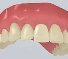 Передний зуб