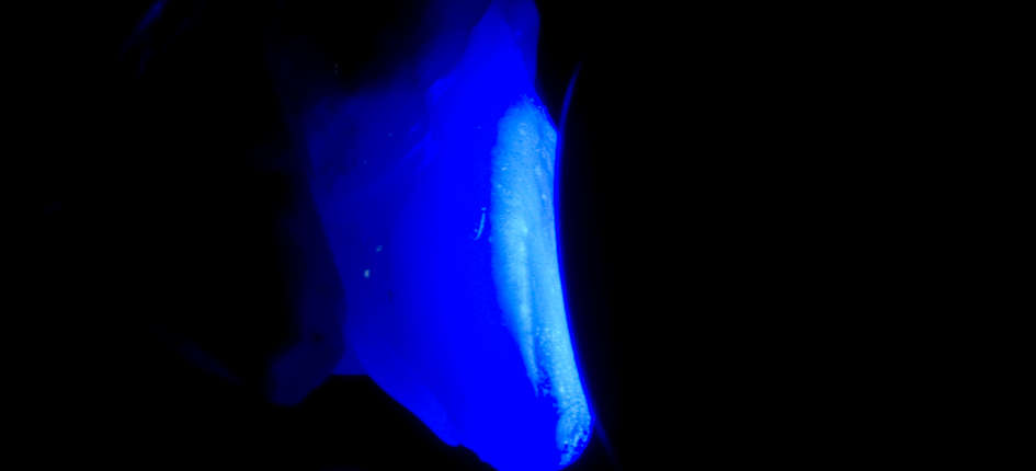 Polymérisation finale
